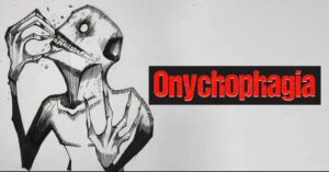 Onychophagia (Nail Biting)