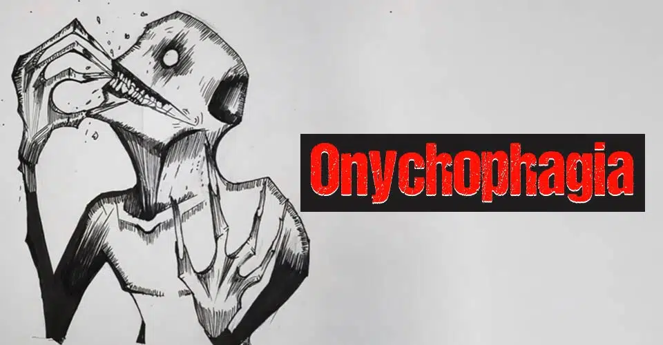 Onychophagia (Nail Biting)