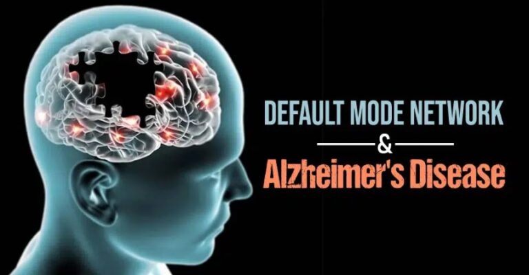 Default Mode Network (DMN) And Alzheimer’s Disease