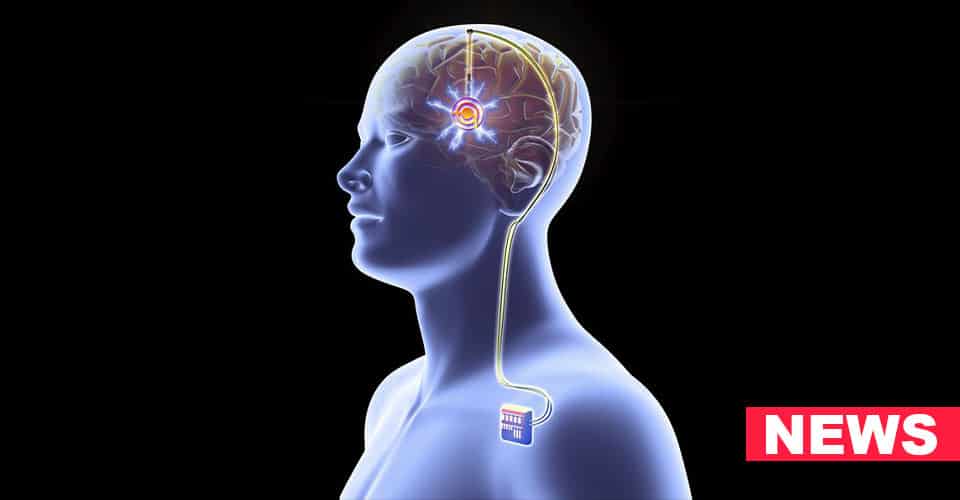 On Demand Brain Stimulation Could News