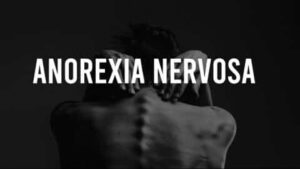 Anorexia Nervosa