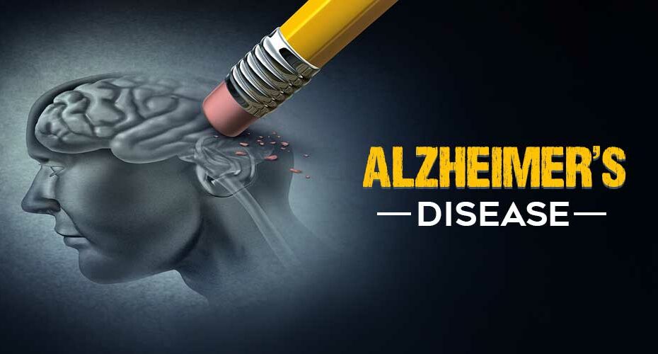 Alzheimers disease site