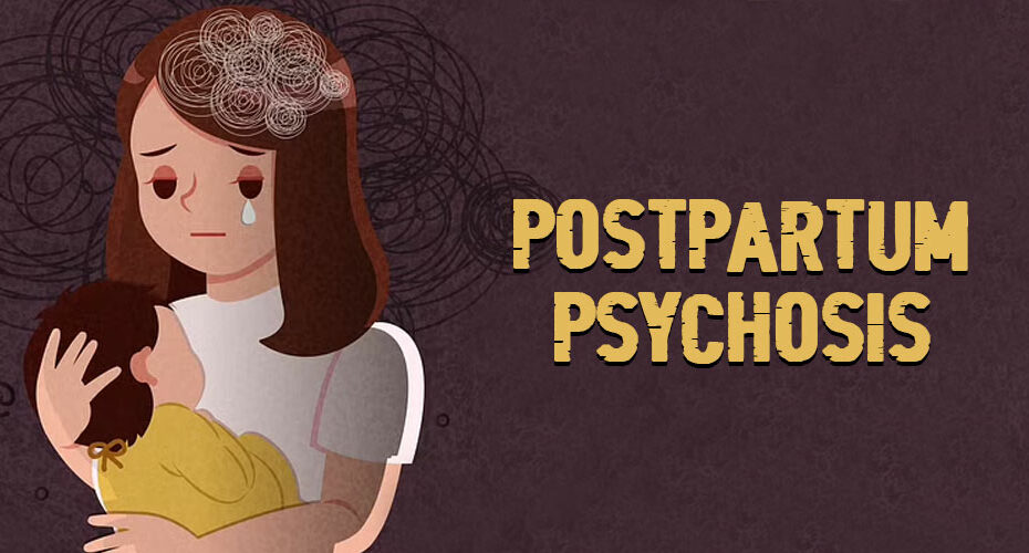 Postpartum Psychosis site