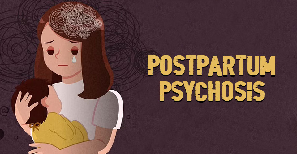 Postpartum Psychosis (PPP) 13 Causes, Signs And Treatment