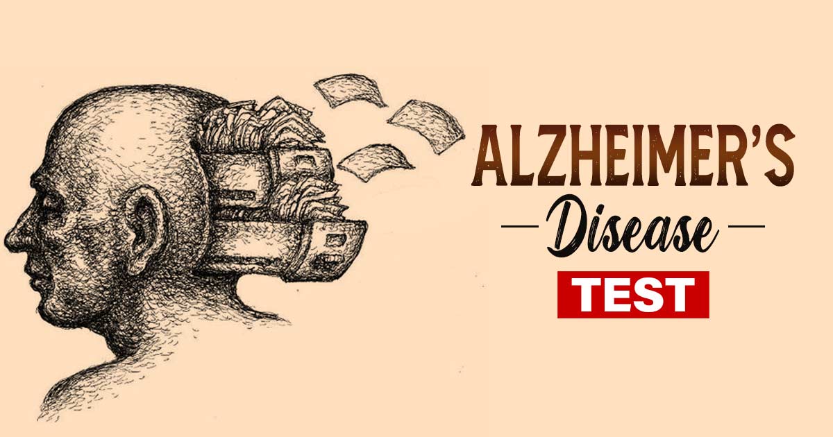Alzheimer’s Disease Test