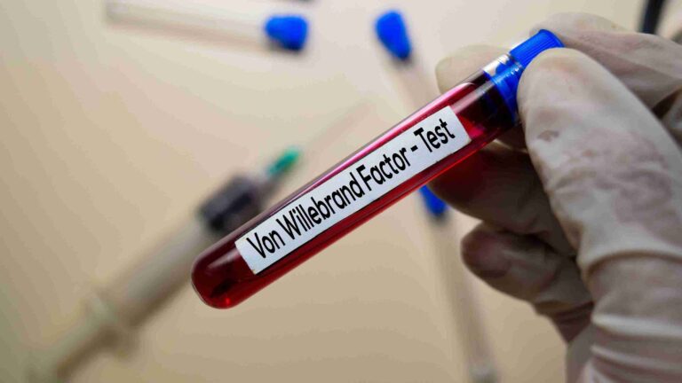 Hematology Von Willebrand Disease Treatment And Management: A Complete Guide